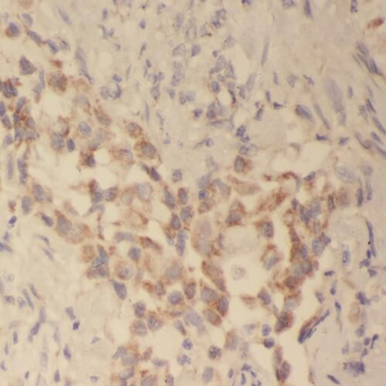 TAP1 Antibody