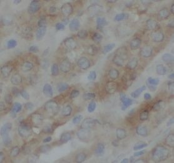 TAX1BP1 Antibody