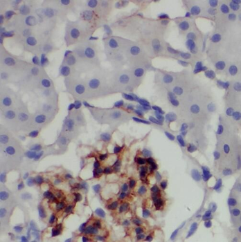 TAX1BP3 Rabbit Polyclonal Antibody
