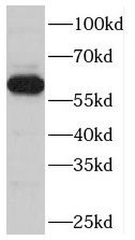 TBC1D24 Rabbit Polyclonal Antibody