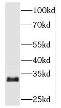 TBCB Rabbit Polyclonal Antibody