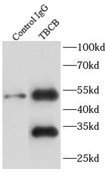 TBCB Rabbit Polyclonal Antibody
