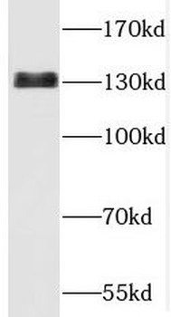 TBCD Rabbit Polyclonal Antibody