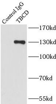 TBCD Rabbit Polyclonal Antibody