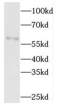 TBCE Antibody
