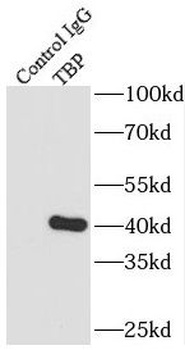TBP Mouse Monoclonal Antibody