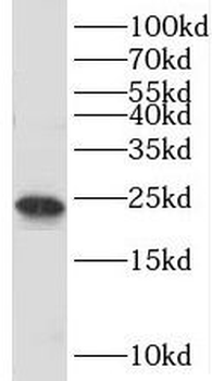 TBPL1 Rabbit Polyclonal Antibody