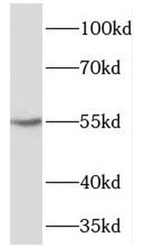 TBX22 Rabbit Polyclonal Antibody