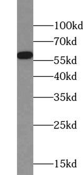 TBXAS1 Rabbit Polyclonal Antibody
