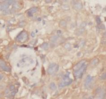 TBXAS1 Rabbit Polyclonal Antibody