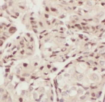 ELOC Antibody