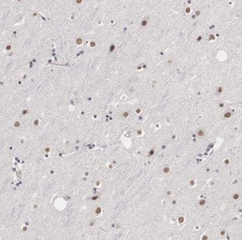 TCERG1 Rabbit Polyclonal Antibody