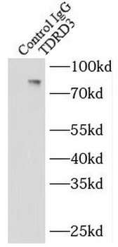 TDRD3 Antibody