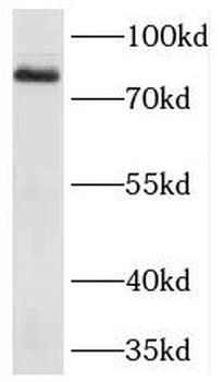CD248 Antibody