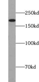 TET2 Rabbit Polyclonal Antibody