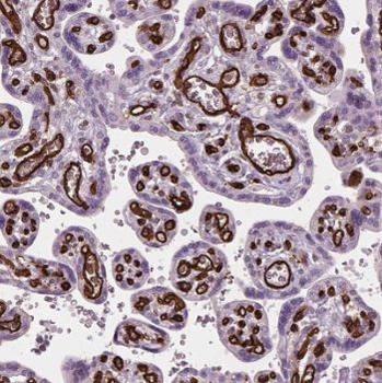 TET2 Rabbit Polyclonal Antibody