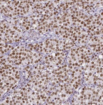 TEX14 Rabbit Polyclonal Antibody