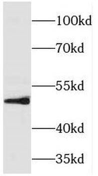 TFAP2B Rabbit Polyclonal Antibody