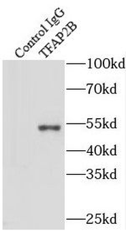 TFAP2B Rabbit Polyclonal Antibody