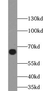 TFE3 Rabbit Polyclonal Antibody