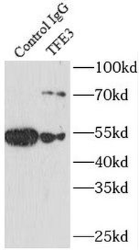 TFE3 Rabbit Polyclonal Antibody