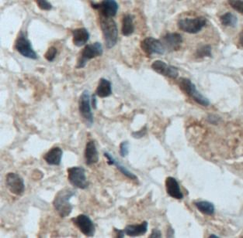 TFE3 Rabbit Polyclonal Antibody