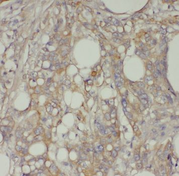 TFEC Rabbit Polyclonal Antibody