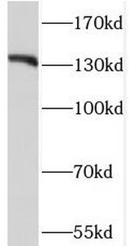 GTF2I Rabbit Polyclonal Antibody