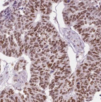 GTF2I Rabbit Polyclonal Antibody