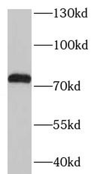 TGFBI Antibody