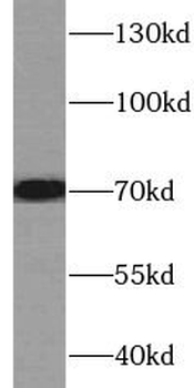 TGFBI Antibody