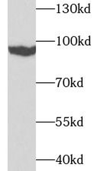 TGM1 Antibody