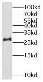 THAP2 Rabbit Polyclonal Antibody