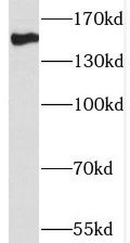 THOC2 Rabbit Polyclonal Antibody