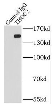 THOC2 Rabbit Polyclonal Antibody