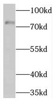 THOP1 Rabbit Polyclonal Antibody