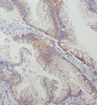 THOP1 Rabbit Polyclonal Antibody