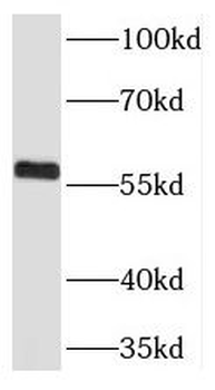 THUMPD3 Rabbit Polyclonal Antibody
