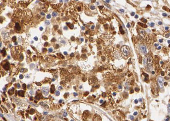 THUMPD3 Rabbit Polyclonal Antibody
