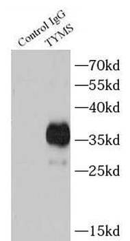 TYMS Antibody