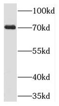 TIGD1 Antibody