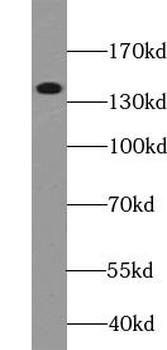 TIMELESS Rabbit Polyclonal Antibody