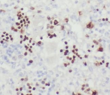 TIMELESS Rabbit Polyclonal Antibody
