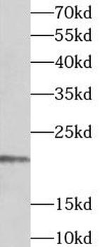 TIMM17A Rabbit Polyclonal Antibody