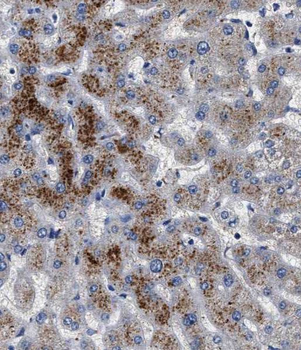 TIMM50 Rabbit Polyclonal Antibody