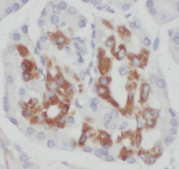 TIMM9 Rabbit Polyclonal Antibody