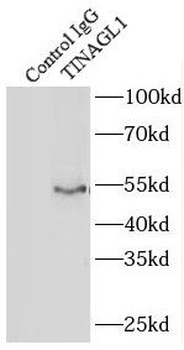 TINAGL1 Antibody
