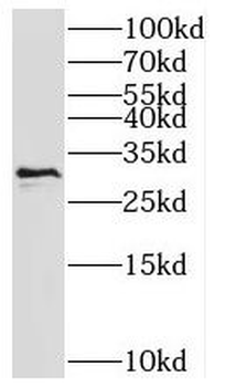 HTATIP2 Rabbit Polyclonal Antibody