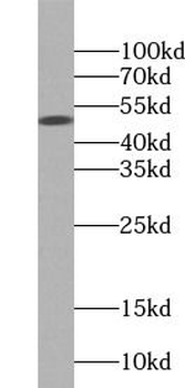 TIPIN Rabbit Polyclonal Antibody