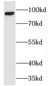 TJAP1 Antibody